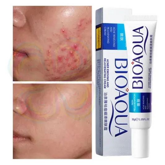 Crema Bioaqua Puntos Negros Anti Acne Cicatrices Poros