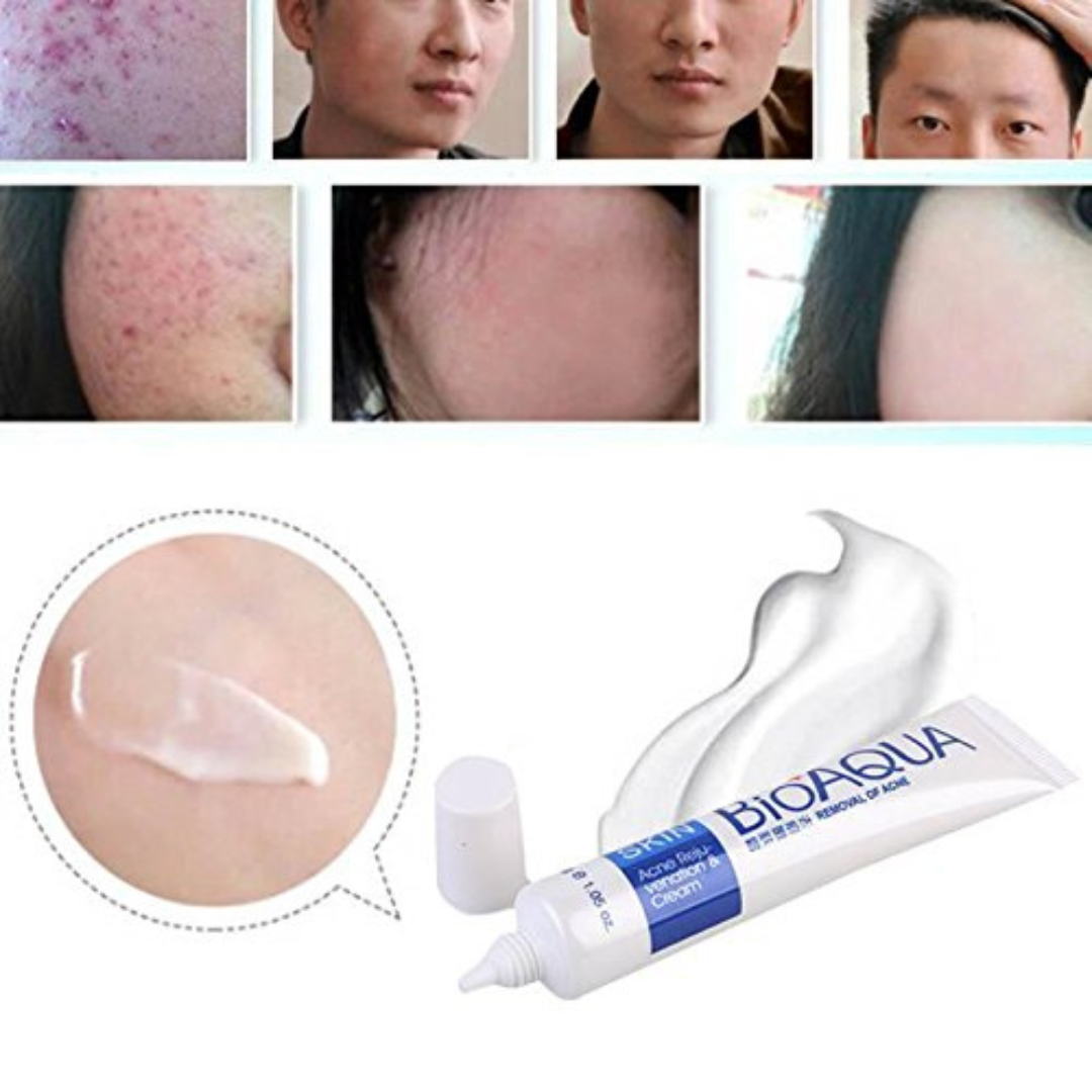 Crema Bioaqua Puntos Negros Anti Acne Cicatrices Poros