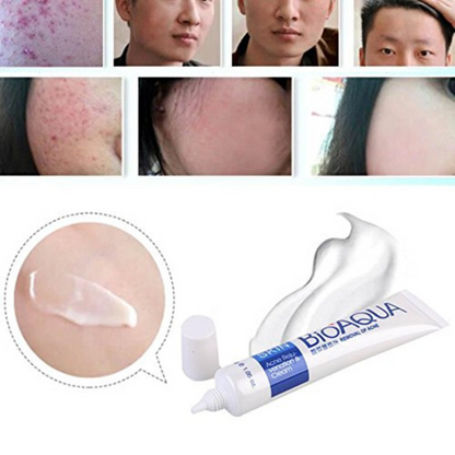 Crema Bioaqua Puntos Negros Anti Acne Cicatrices Poros
