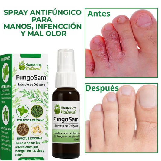 Micostop Spray Antifúngico Natural – Pies, Manos y Articulaciones oregano