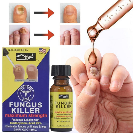Removedor Hongos y reparador Avanzado de Uñas